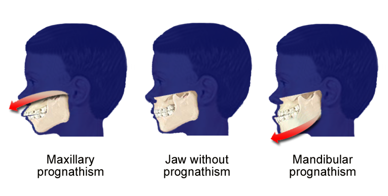 Charles Jaw