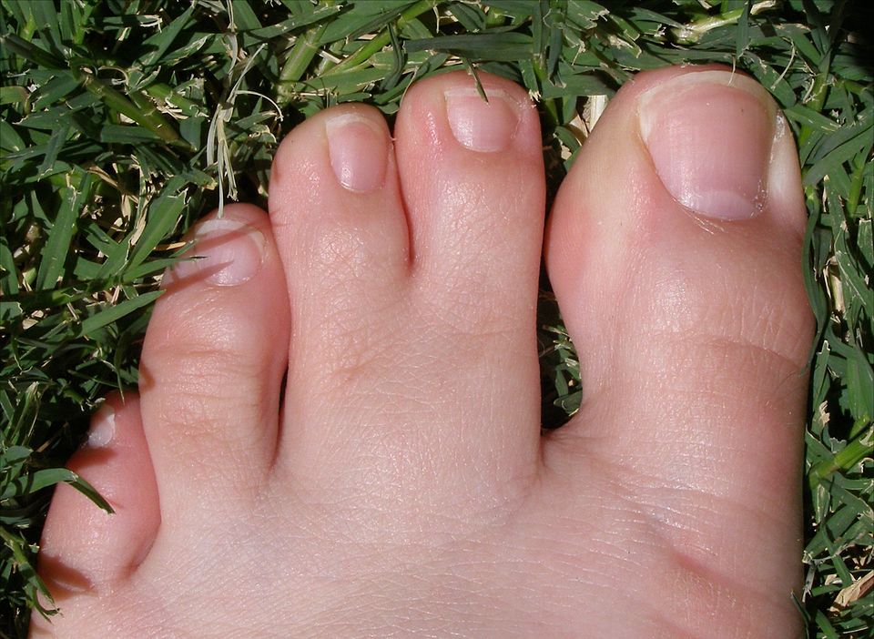 Cynthia Toe