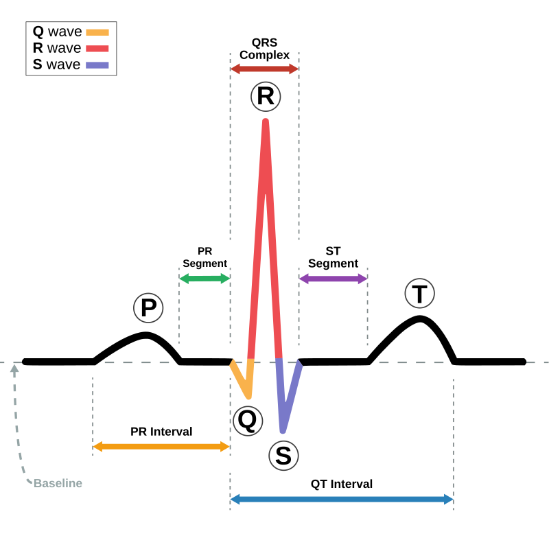 EKG