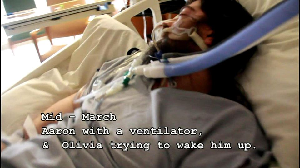 MD Coma