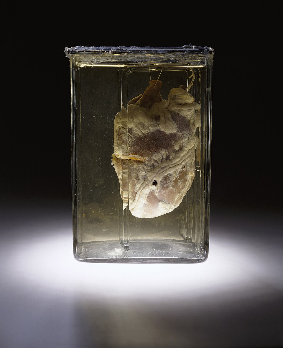 Unknown Forensic Pathologist