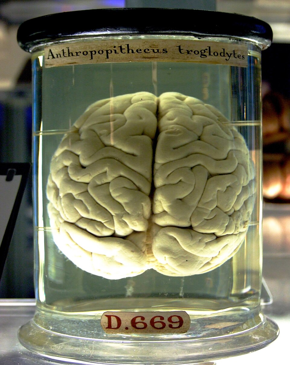 Will Brain