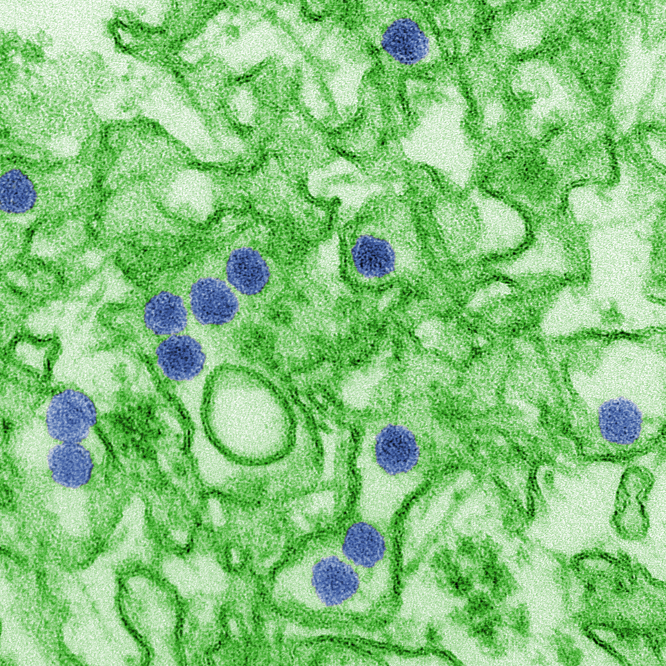 Zika